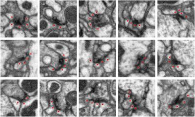 Fully-Automatic Synapse Prediction and Validation on a Large Data Set